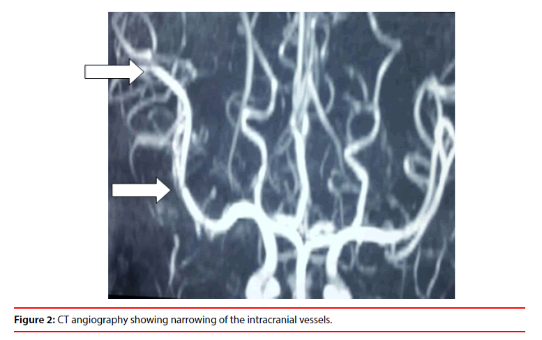 clinical-skills-intracranial-vessels