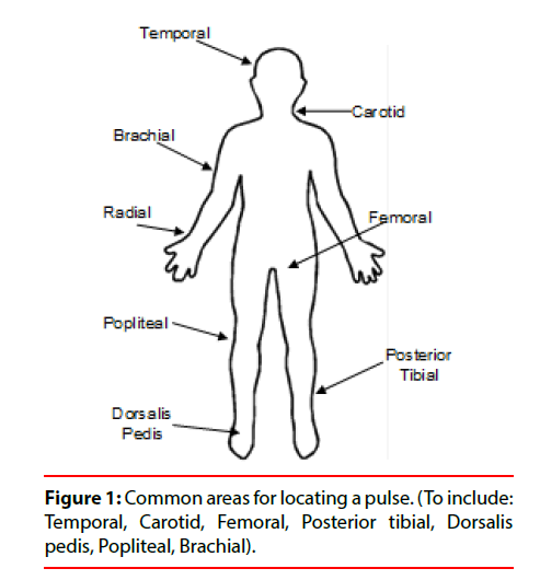clinical-skills-locating-pulse