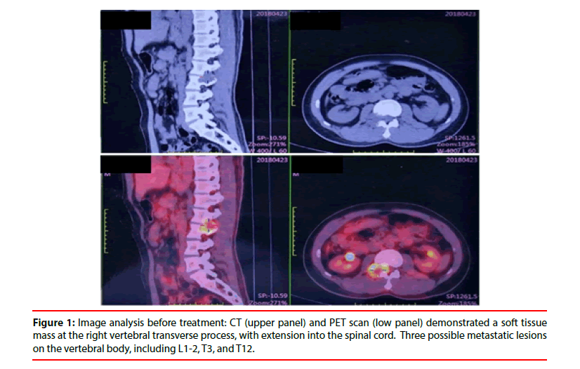 clinical-skills-vertebral-transverse