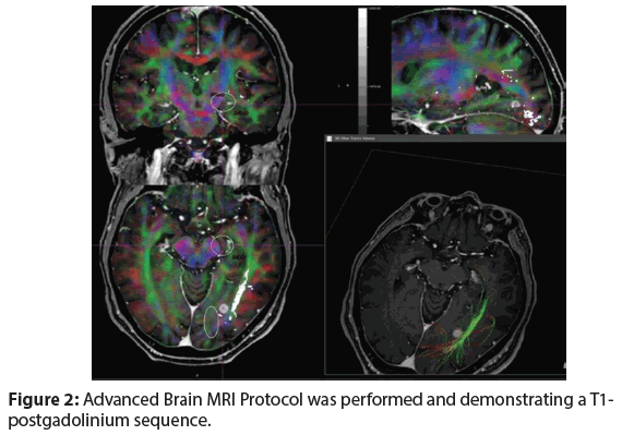 Neuropsychiatry-London