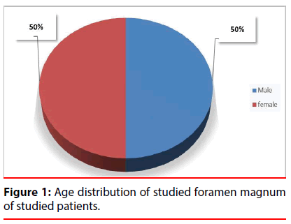 ijocs-Age-distribution