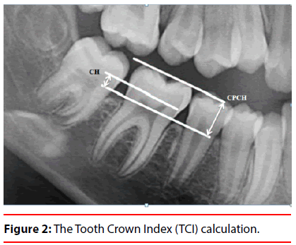 ijocs-Tooth