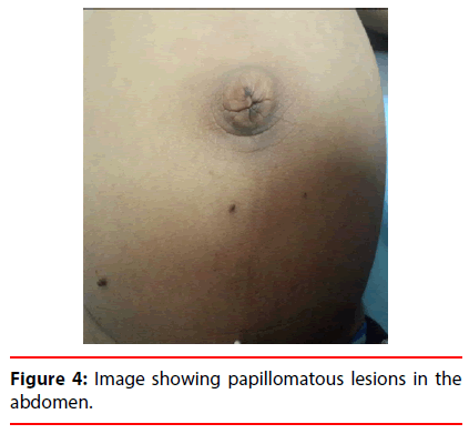 ijocs-abdomen