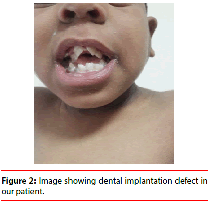 ijocs-dental