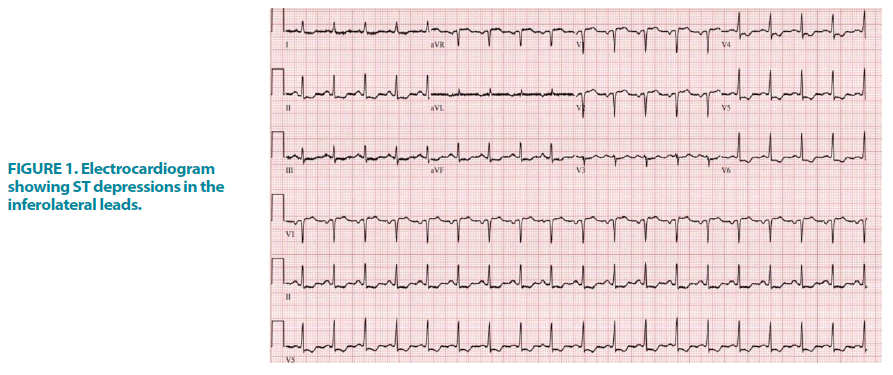 clinical-practice-Electrocardiogram