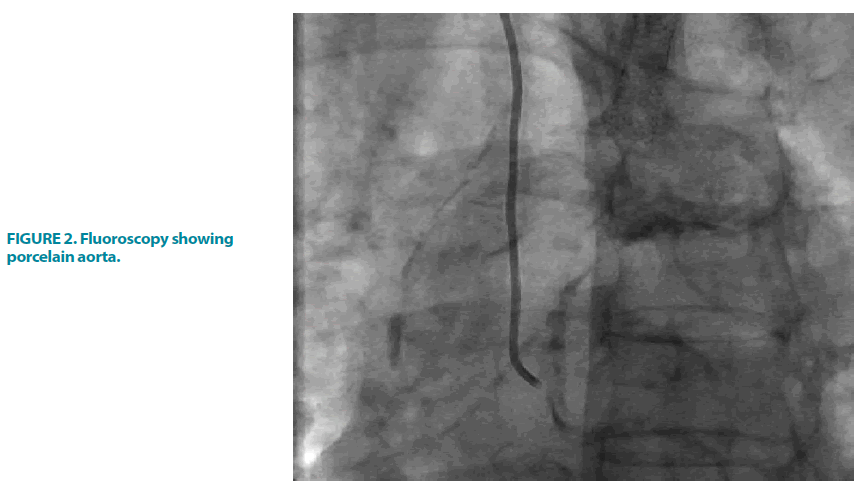 clinical-practice-Fluoroscopy