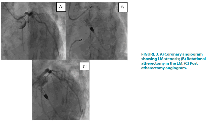 clinical-practice-angiogram