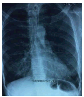 clinical-practice-cannula