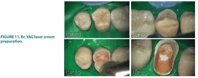 clinical-practice-crown