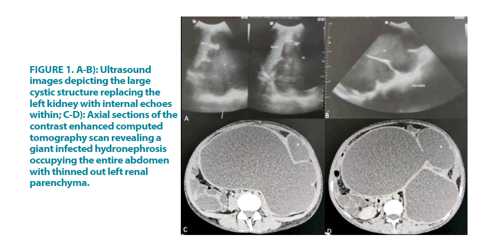 clinical-practice-cystic-structure