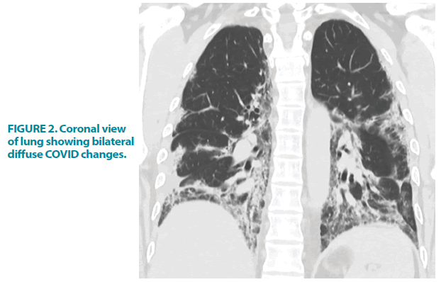 clinical-practice-lung