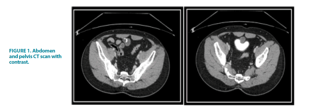 clinical-practice-pelvis-CT-scan