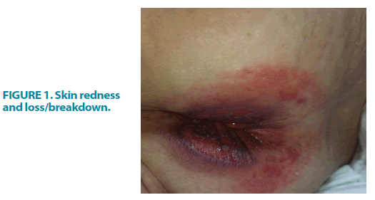 clinical-practice-redness