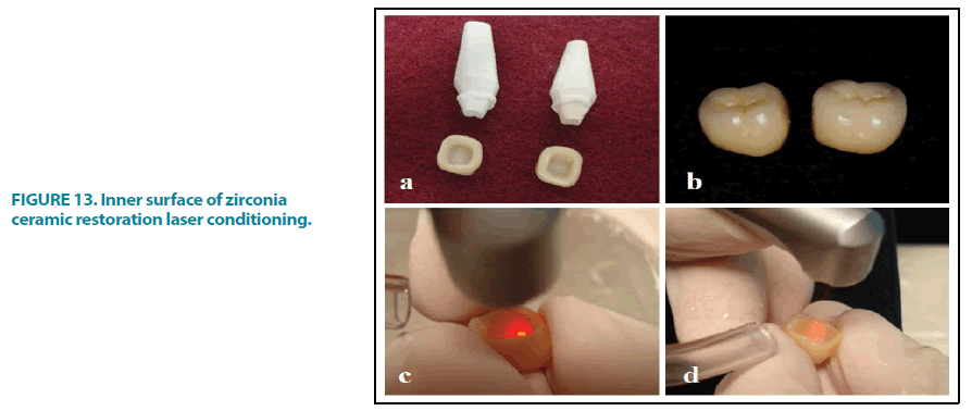 clinical-practice-zirconia