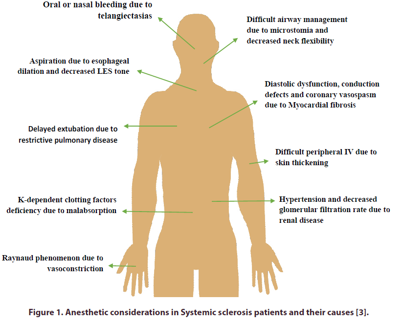 clinical-rheumatology-Anesthetic