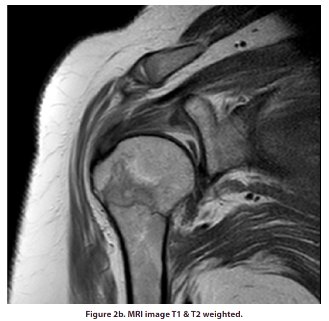 clinical-rheumatology-MRI
