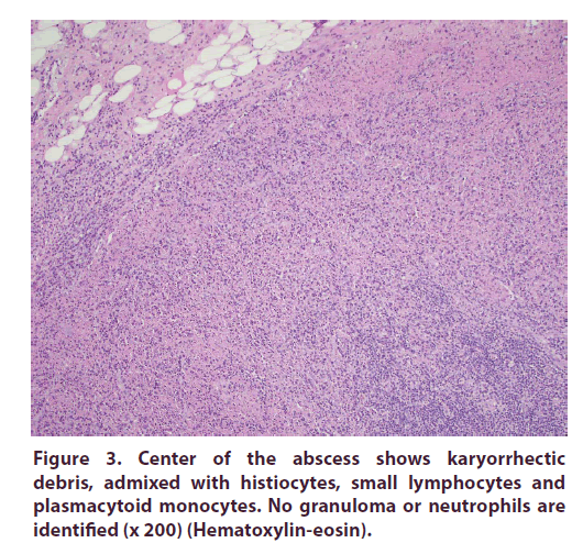 clinical-rheumatology-abscess