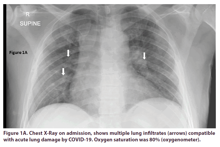 clinical-rheumatology-admission