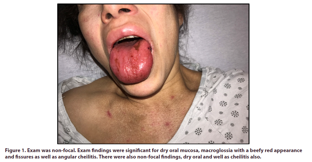 clinical-rheumatology-cheilitis