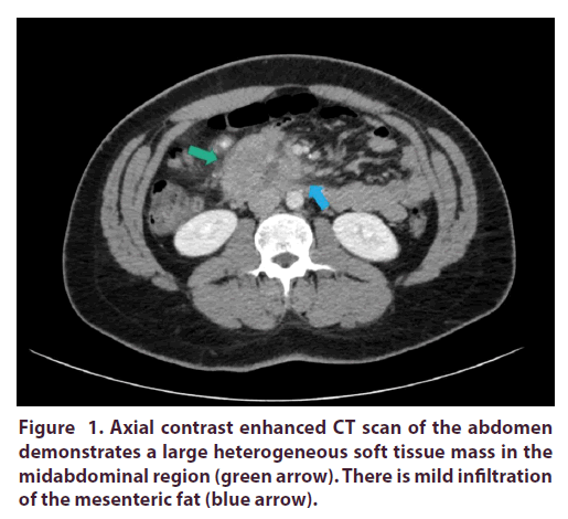 clinical-rheumatology-contrast