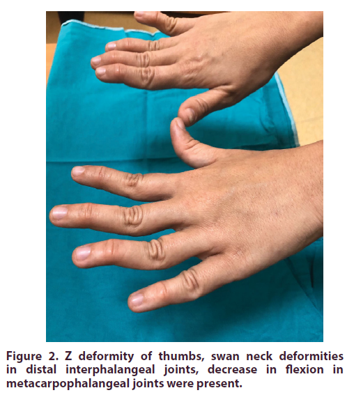 clinical-rheumatology-deformity