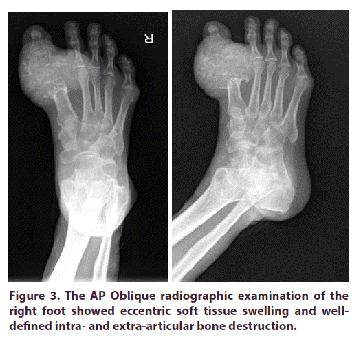 clinical-rheumatology-eccentric