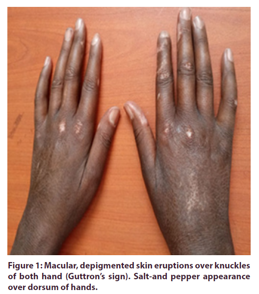clinical-rheumatology-eruptions
