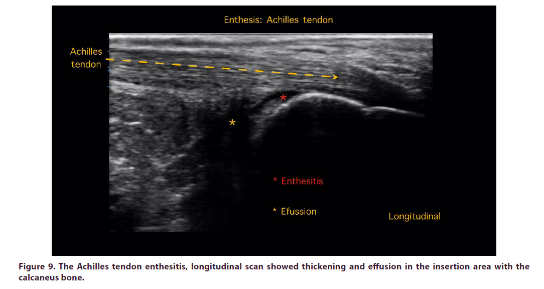 clinical-rheumatology-insertion