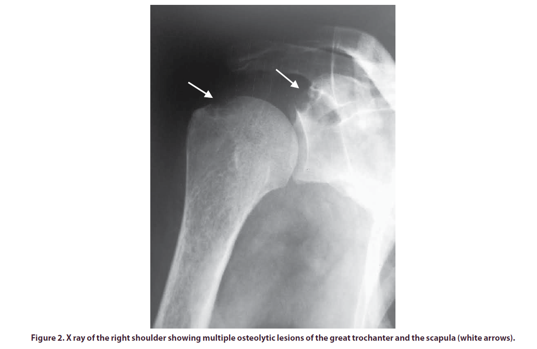 clinical-rheumatology-lesions