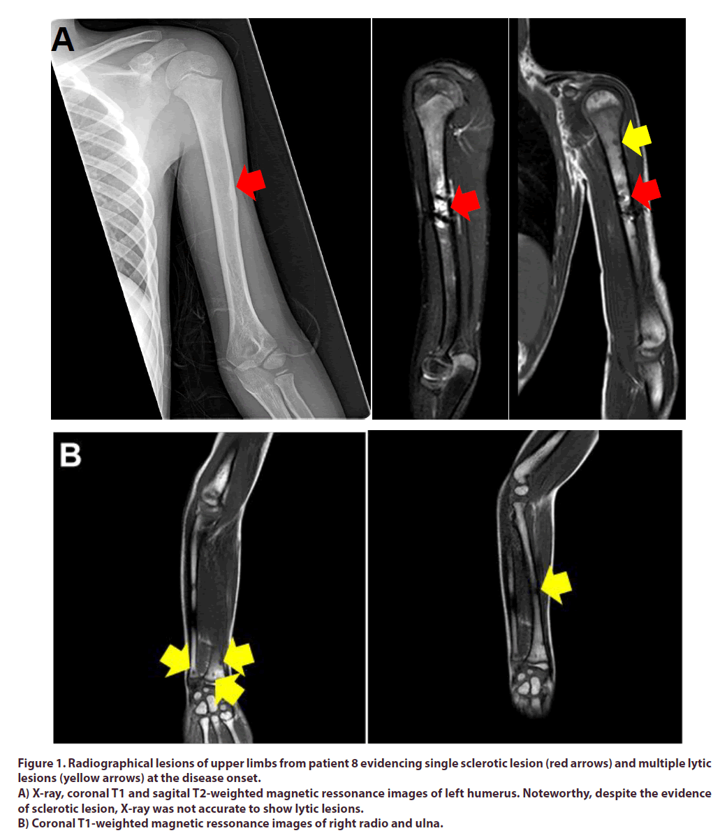 clinical-rheumatology-limbs