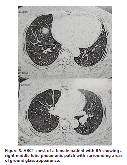 clinical-rheumatology-patient