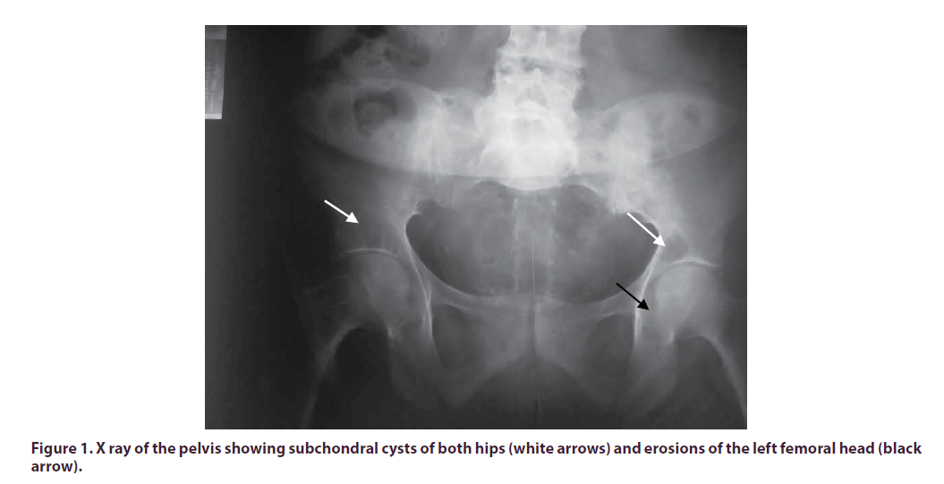 clinical-rheumatology-pelvis