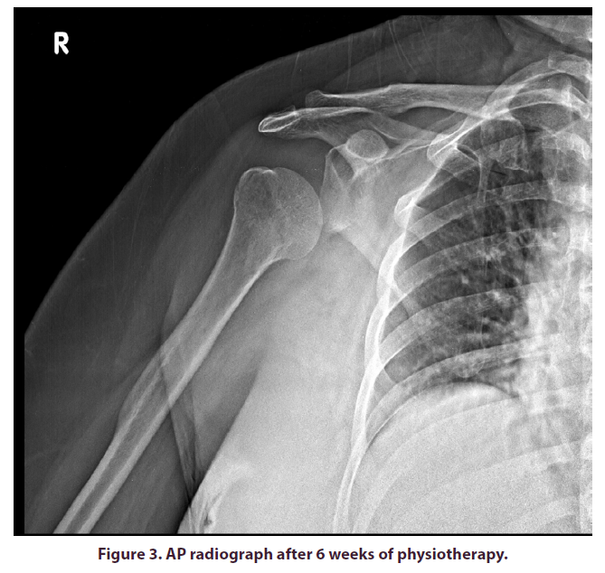 clinical-rheumatology-physiotherapy