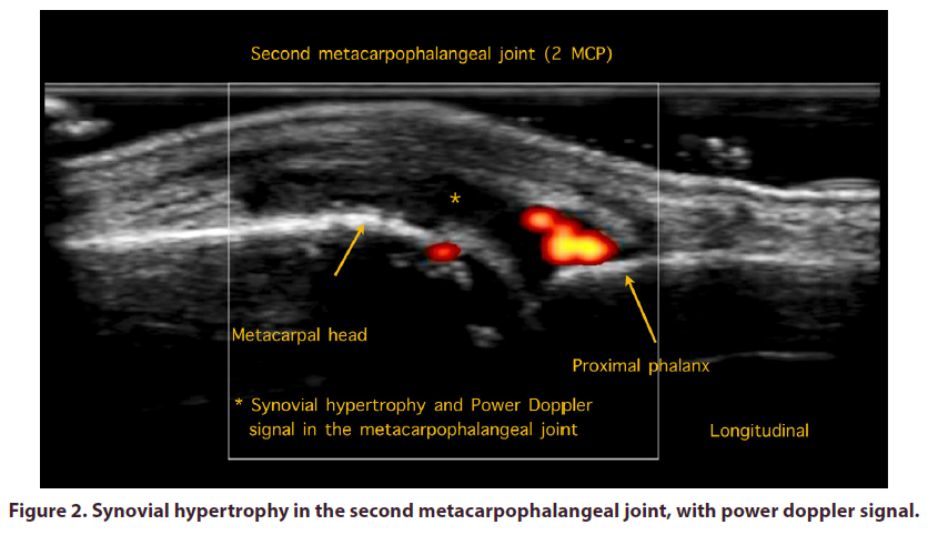 clinical-rheumatology-power