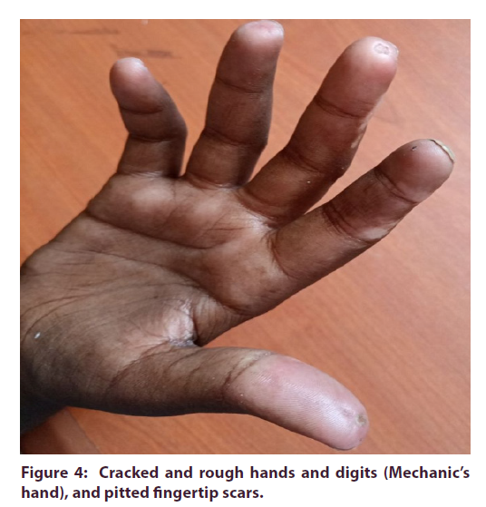 clinical-rheumatology-rough