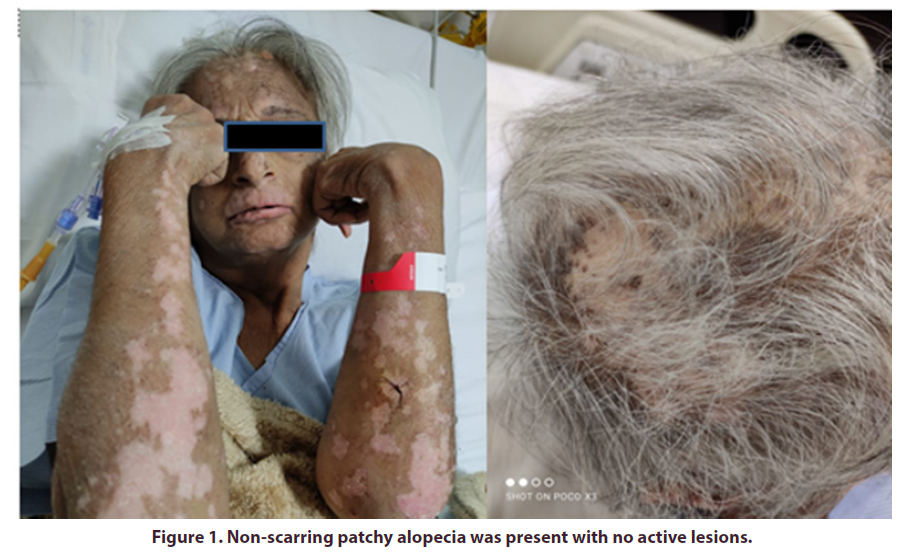 clinical-rheumatology-scarring