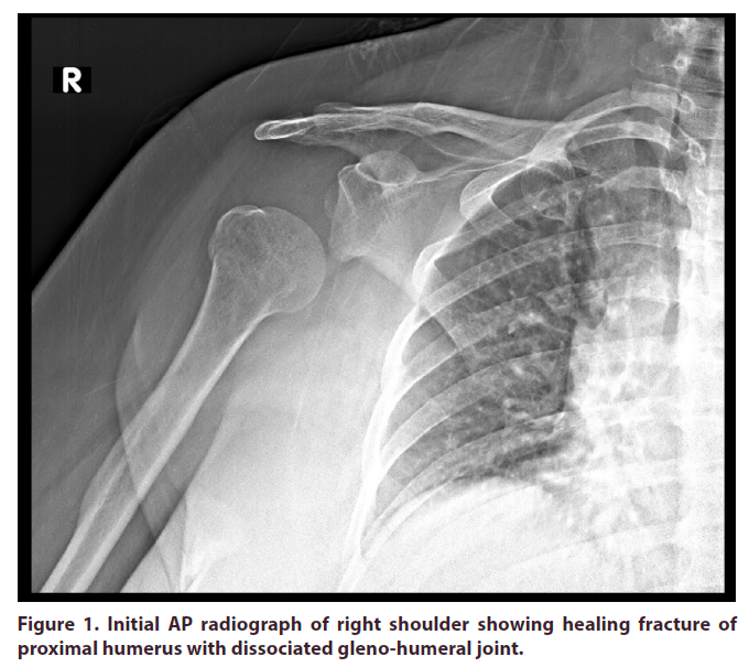 clinical-rheumatology-shoulder