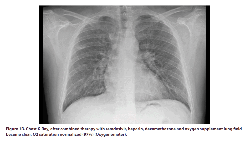 clinical-rheumatology-therapy