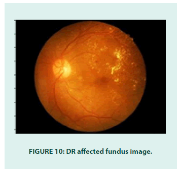 diabetes-management-affected