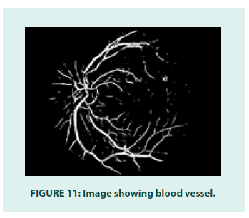 diabetes-management-blood