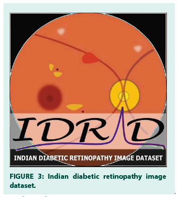 diabetes-management-dataset