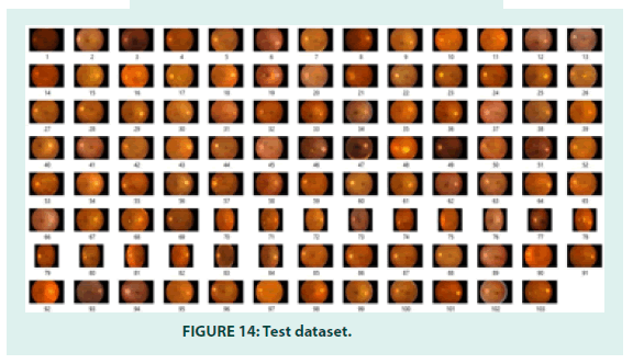 diabetes-management-dataset