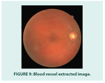 diabetes-management-extracted