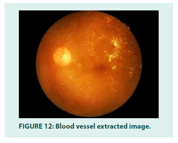 diabetes-management-extracted