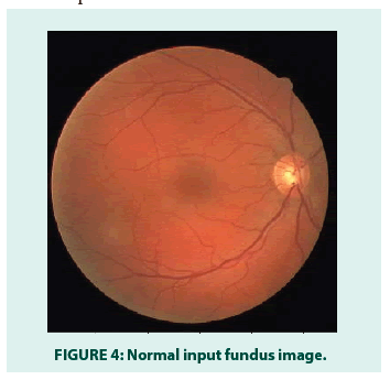 diabetes-management-fundus