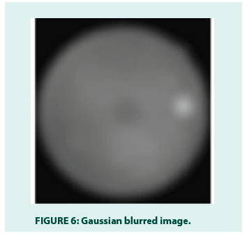 diabetes-management-gaussian