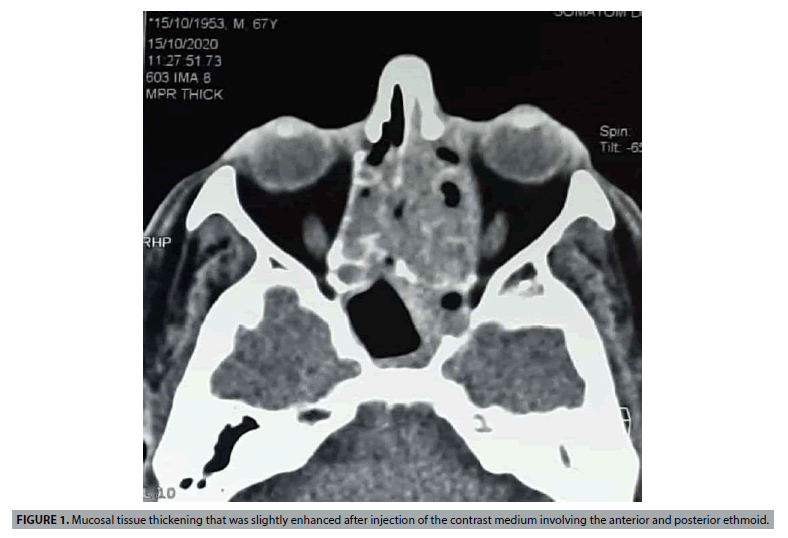 anterior