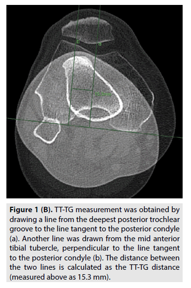 imaging-posterior