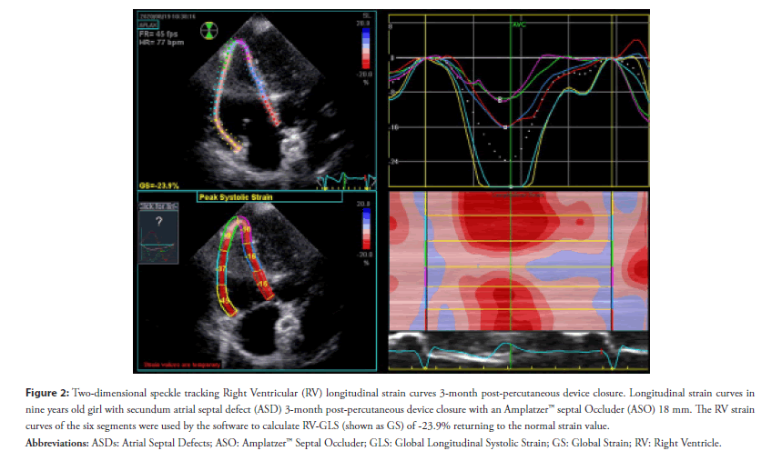 interventional-cardiology-summarizing