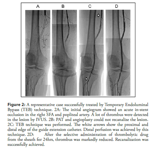 interventional-cardiology-angiogram